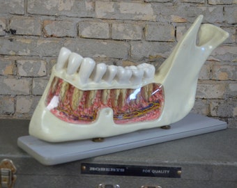 Puede incluir: Un modelo anatómico vintage de una mandíbula humana con dientes y encías. El modelo está hecho de plástico blanco y muestra la estructura interna de la mandíbula. El modelo está sobre una base gris con el texto "ROBERTS FOR QUALITY" impreso en él.