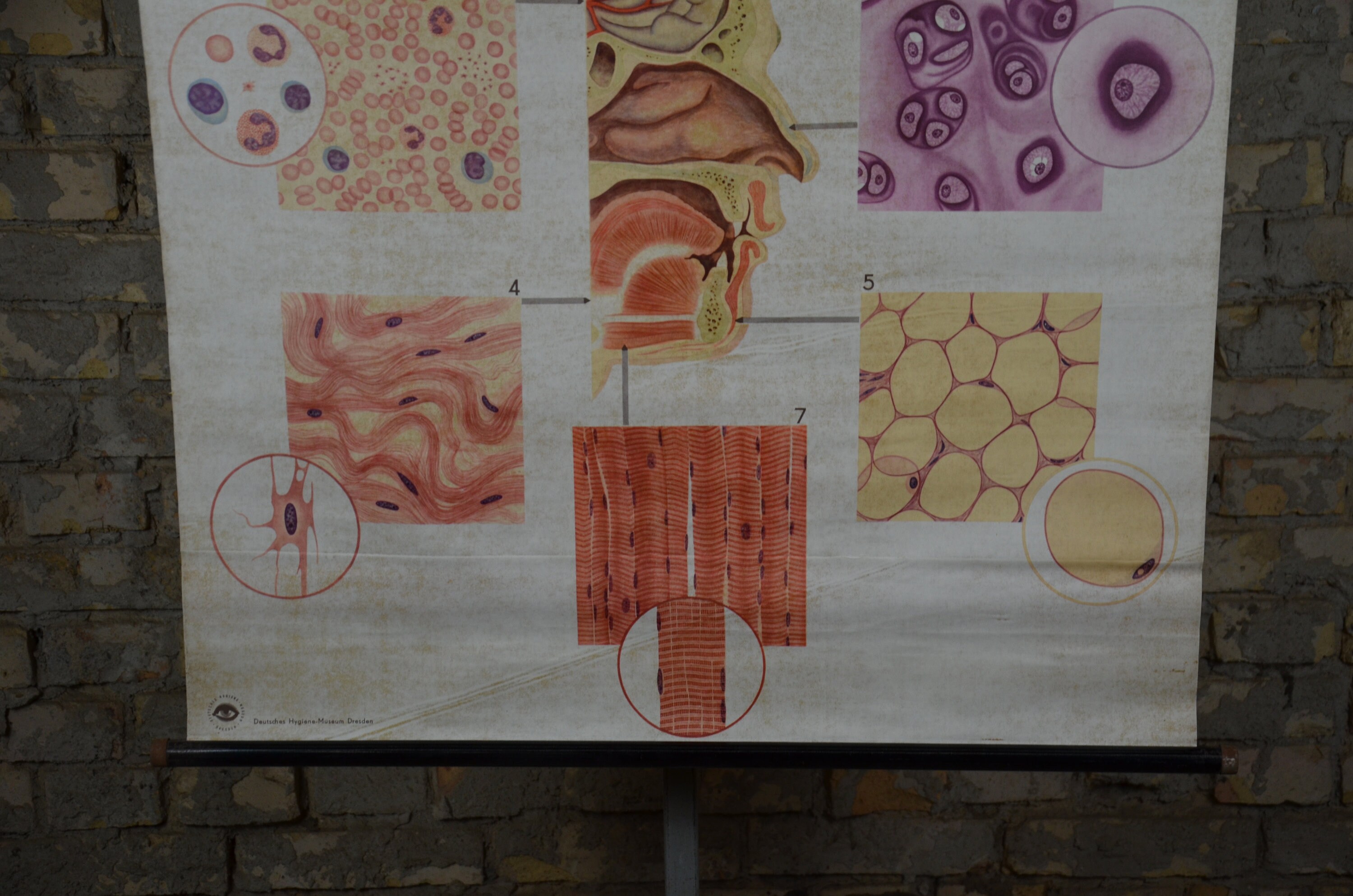 Human Head Tissue Anatomy: Original Vintage 1970s German Medical ...