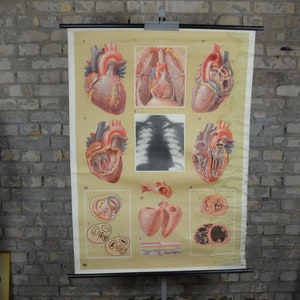 Menschliches Herz, Anatomischer Druck: Distressed original Vintage 1950er Jahre Deutsch Medizinisches Lehrplakat Schulwandtafel Anatomie Blut X-Ray