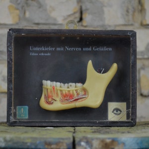 Human Teeth, Jaw Nerves, Karies: original vintage 1950s wax moulage anatomical model anatomy German medical educational dental display box