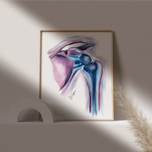 Shoulder replacement art print-Orthopedic surgery art-anatomical art - musculoskeletal anatomy-joint replacement-Orthopedic surgeon gift