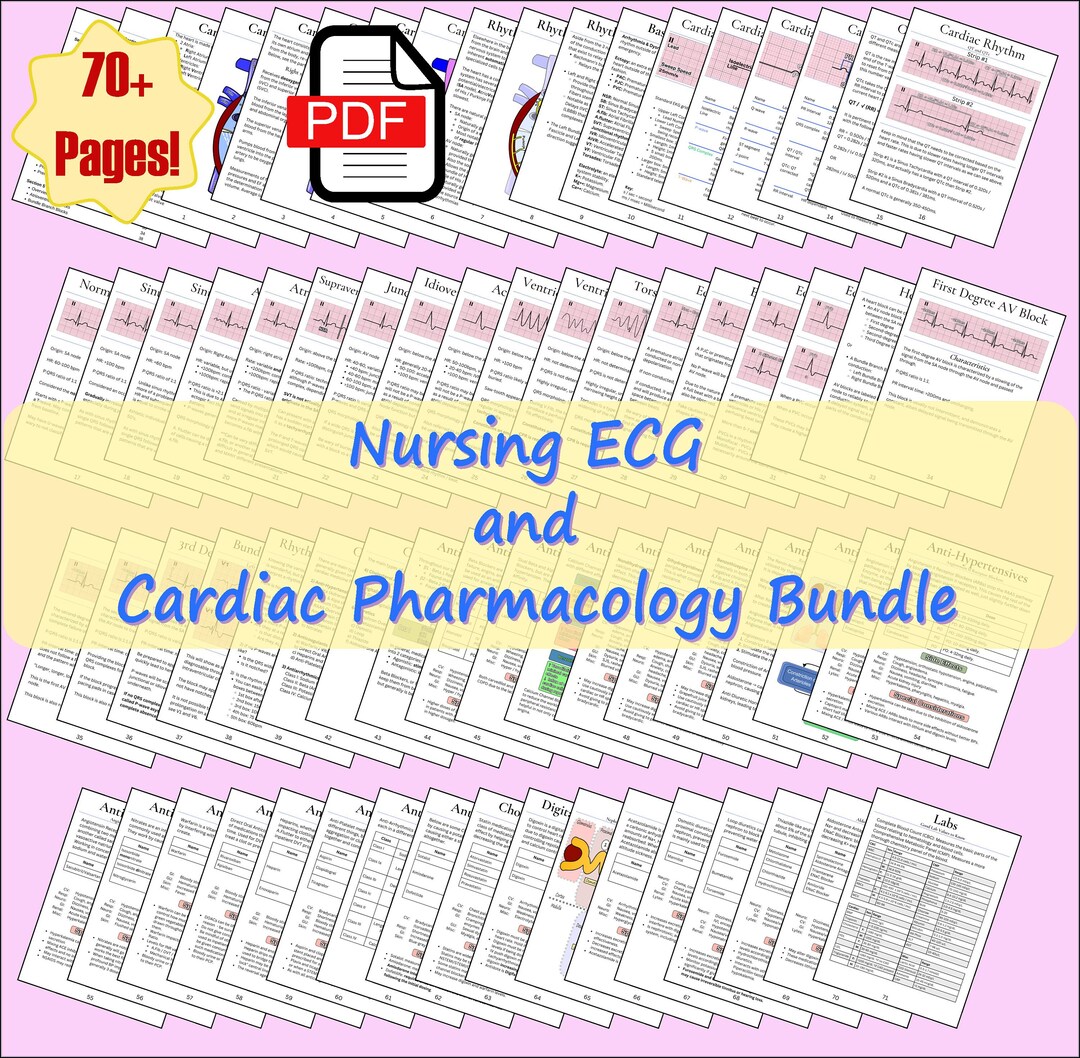 Nursing ECG and Cardiac Pharmacology Guide (digital Download) - Etsy