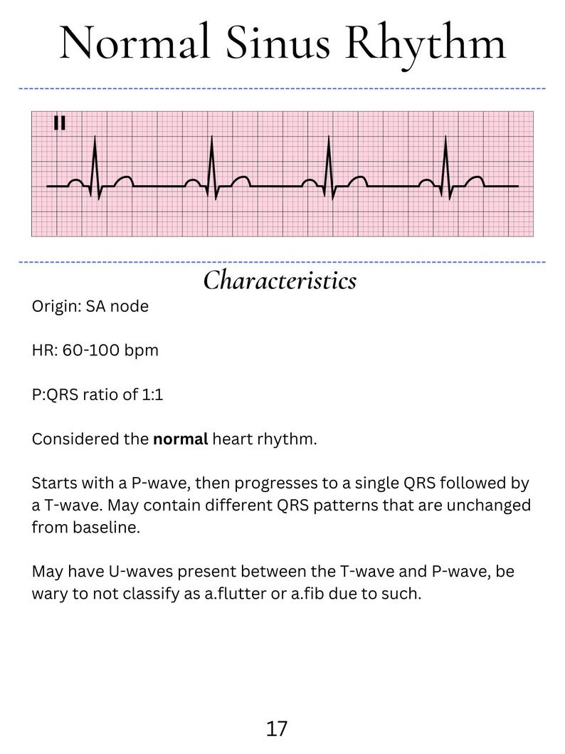 Nursing ECG and Cardiac Pharmacology Guide (digital Download) - Etsy