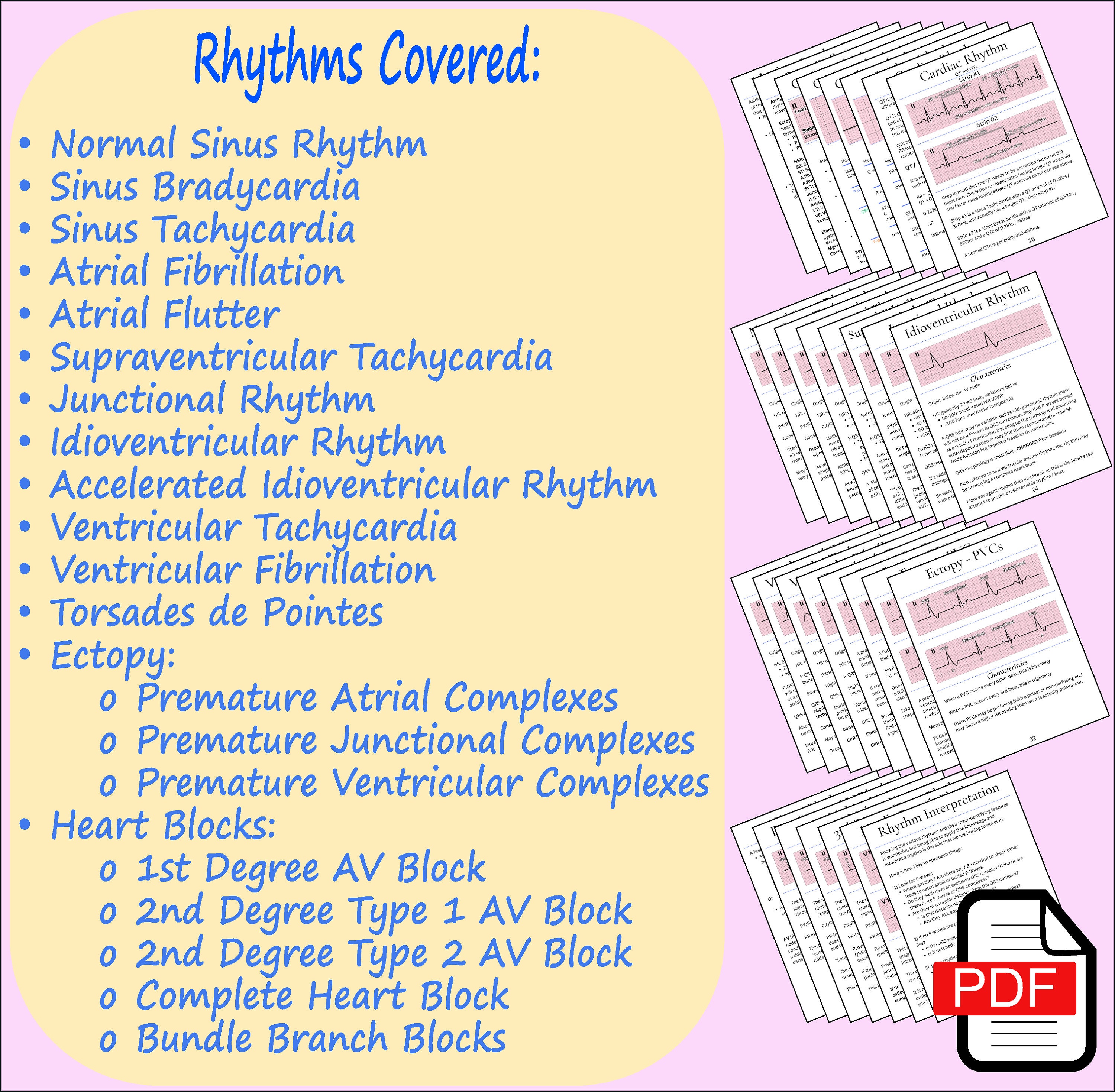 Nursing ECG and Cardiac Pharmacology Guide (digital Download) - Etsy