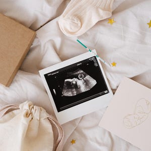 Scatola per annunciare la gravidanza a marito, genitori e amici: calzini per neonati, sacchetto di cotone e biglietto. Basta aggiungere un test di gravidanza o un'ecografia del bambino