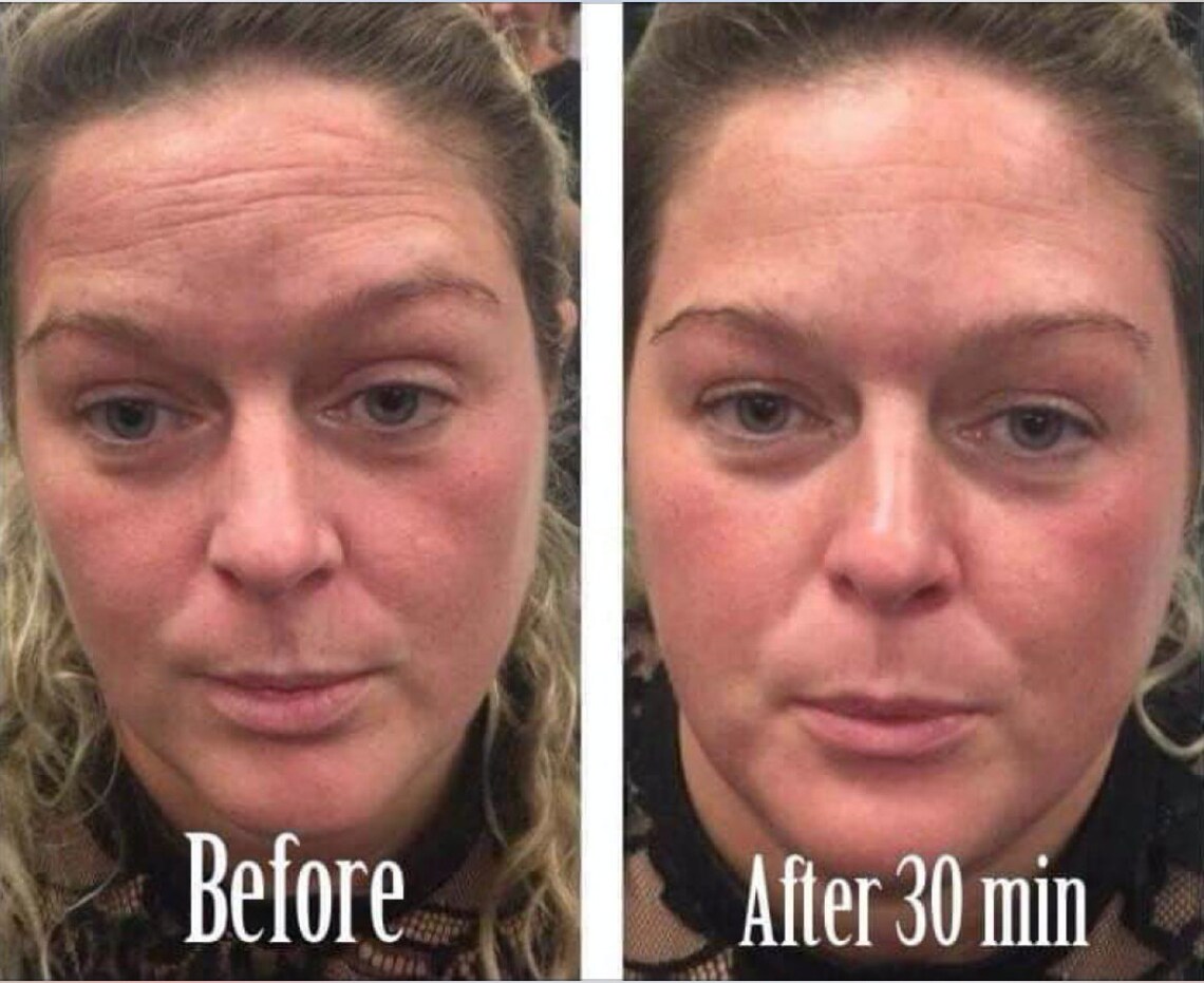 Nu Skin Face Lift with Activator 2 Products Botox in a Etsy