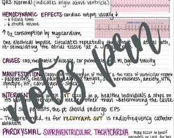 看護ノート - 上室性頻拍