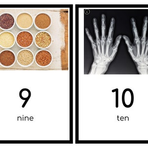 Puede incluir: Dos im&aacute;genes que muestran los n&uacute;meros 9 y 10. La primera imagen muestra nueve cuencos peque&ntilde;os llenos de diferentes tipos de granos. La segunda imagen muestra una radiograf&iacute;a de dos manos.