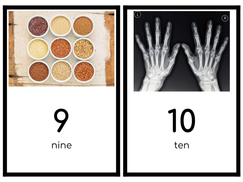 Puede incluir: Dos im&aacute;genes que muestran los n&uacute;meros 9 y 10. La primera imagen muestra nueve cuencos peque&ntilde;os llenos de diferentes tipos de granos. La segunda imagen muestra una radiograf&iacute;a de dos manos.
