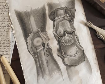 Antik anatomikonst Anatomisk vintagedekor Knäet - Lizars 1824 'System av anatomiska plattor'