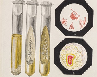 Antique Bacteriology print of bacillus Pied de Madura Farcin Du boeuf 1898 Colour lithograph print size ca.9,5x6,1 Microorganism.