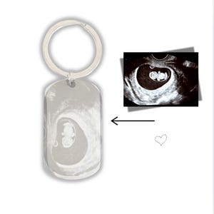Op de afbeelding: Een zilveren sleutelhanger met een zwart-witte echografie van een baby op een rechthoekig label. De sleutelhanger heeft een zilveren ring.