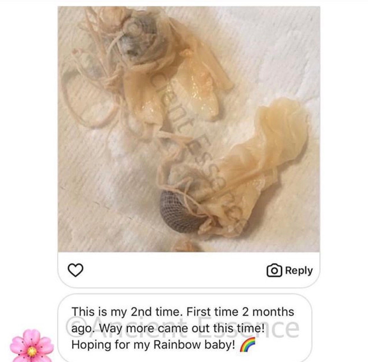 Yoni Pearls Herbal Feminine Yoni Detox Pearl Cleanse 100 Etsy