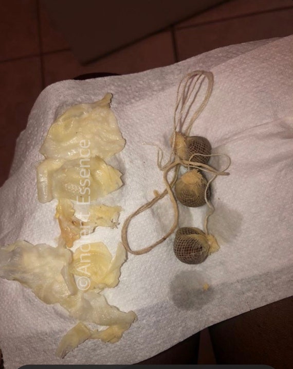 Bacterial Vaginosis BV Yoni Detox Pearl Kit / Vaginal Womb Etsy
