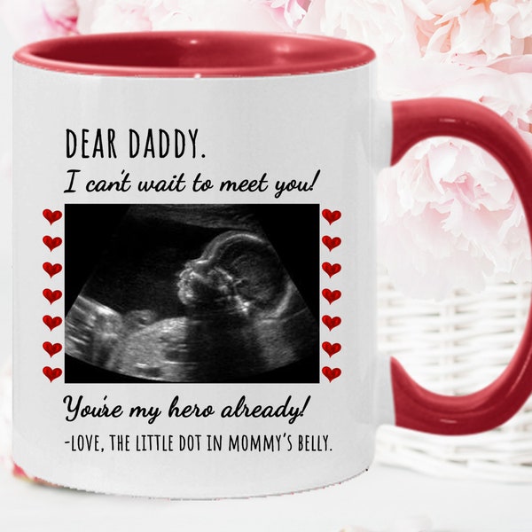 Dear Daddy I Can't Wait To Meet You, Personalized Ultrasound Photo Coffee Mug, Pregnancy Reveal To Husband, Best Custom Gift Ideas for Dad