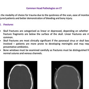 CT Head Revision Notes for Radiography Students
