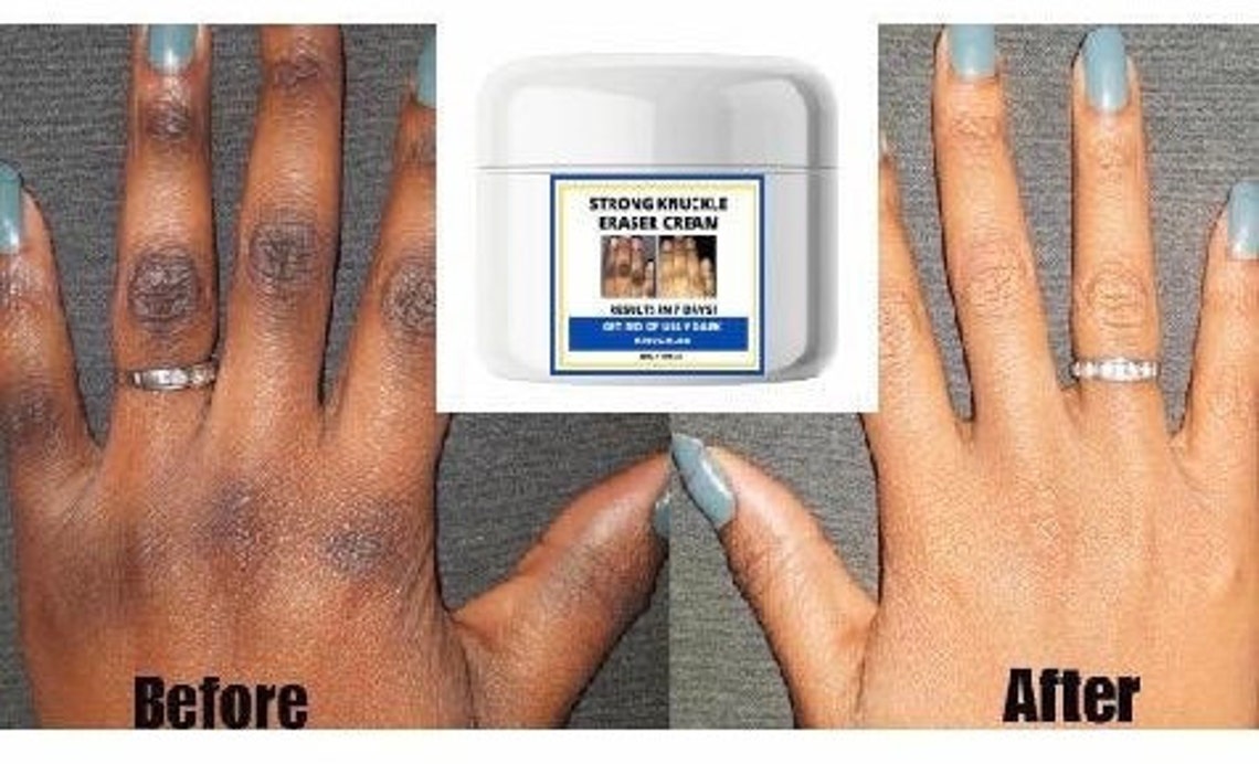 Dark knuckles cream dark knuckles fade eraser cream dark Etsy