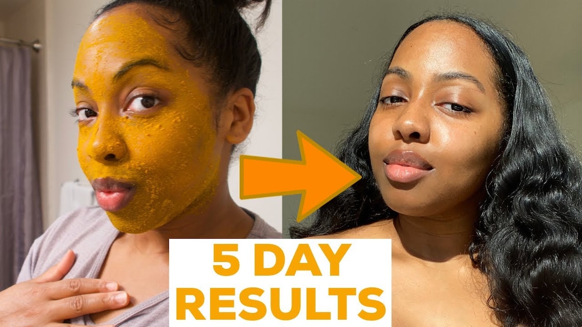 Turmeric Honey Apple Cider Face Mask Even Skin Tone Acne & Etsy