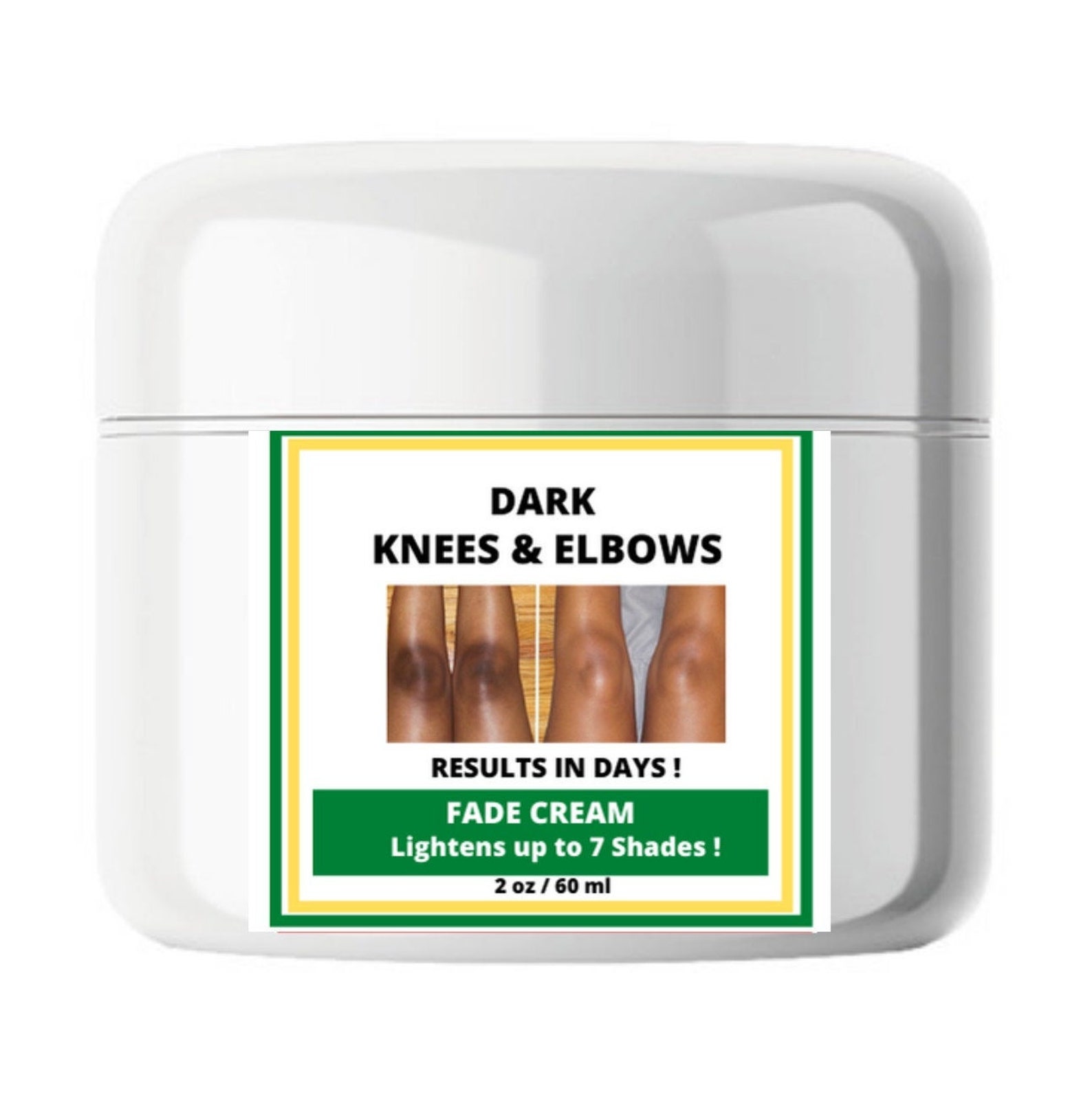 Dark Knees and Elbows Cream Dark Knees and Elbows Fade Etsy