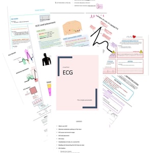 Peut inclure: Un guide illustré rose et blanc pour la lecture d'un électrocardiogramme (ECG) avec le titre "ECG simplifié : Le simple paramédical". Le guide comprend une table des matières avec des sujets tels que "Qu'est-ce qu'un ECG ?", "Les 10 règles de Chamberlain pour un ECG normal" et "Lecture et interprétation de l'ECG (étape par étape)".