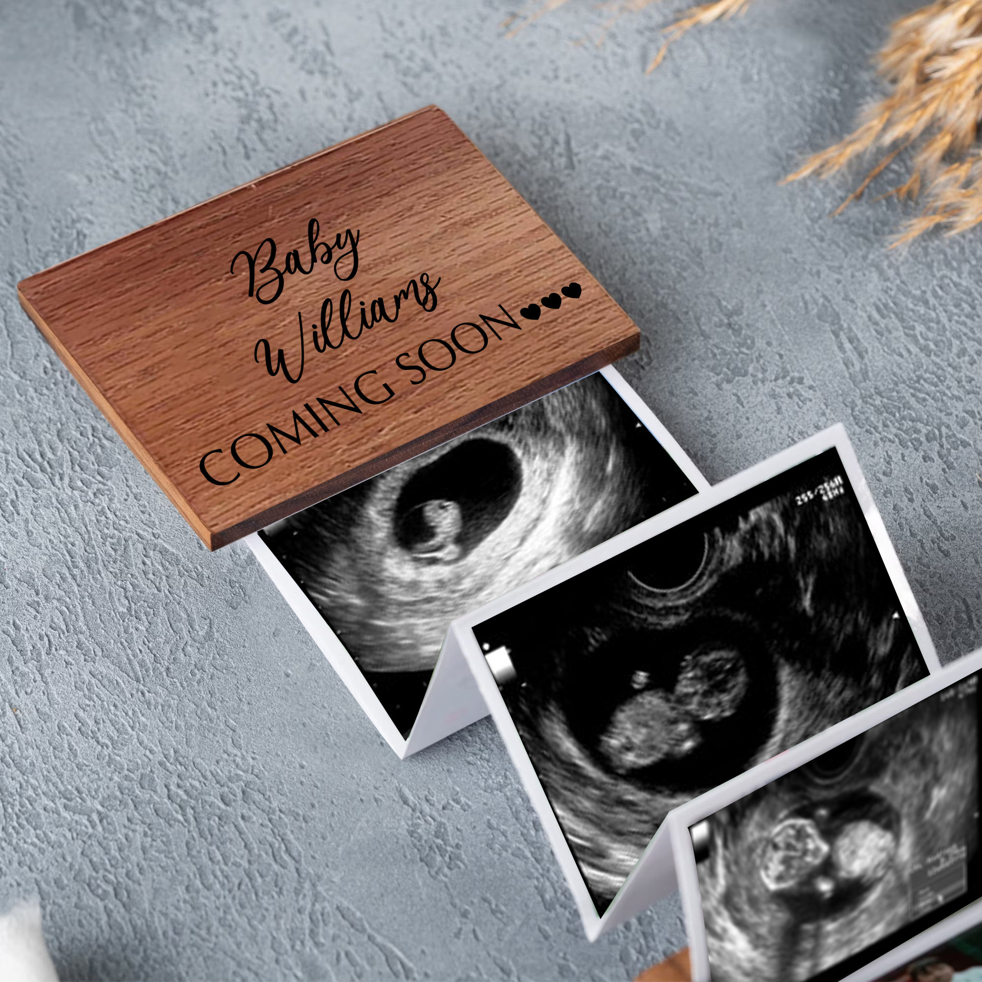 Baby Photos Milestones Album Para Android - Download