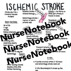 Guide clinique rapide sur l'AVC pour étudiants en soins infirmiers, infirmières praticiennes, notes médicales, feuilles d'étude, infirmière autorisée, esthétique, organisation, manuscrit