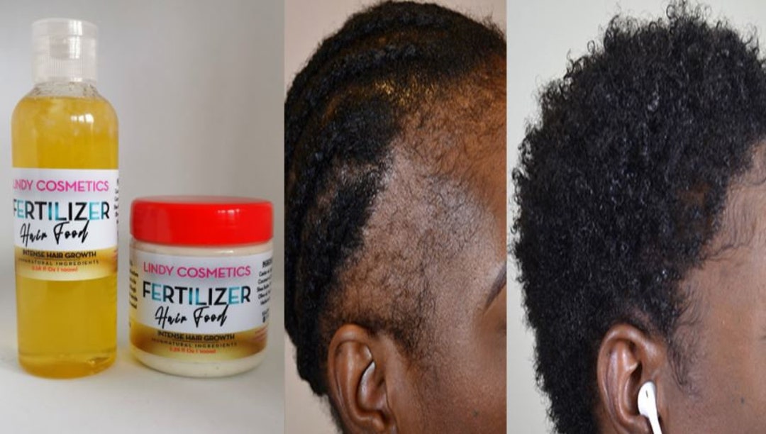 HAIR GROWTH FERTILIZER for Hair Loss, Alopecia, Edges, Beard, Breakage