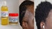 HAIR GROWTH FERTILIZER for Hair Loss, Alopecia, Edges, Beard, Breakage, Thicker Hair, Scalp Oil Treatment *100ml(3.4 oz) *200ML (6.76 oz) 