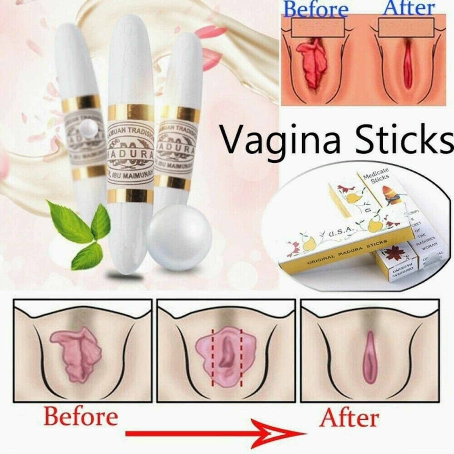 Vaginal Tightening Wand