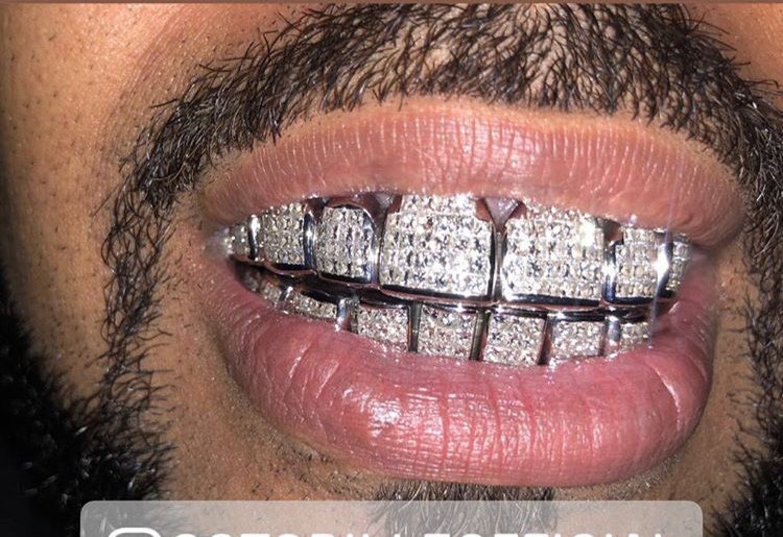 Grillz Express Custom Invisible Set Diamonds Iced Out Grillz Etsy