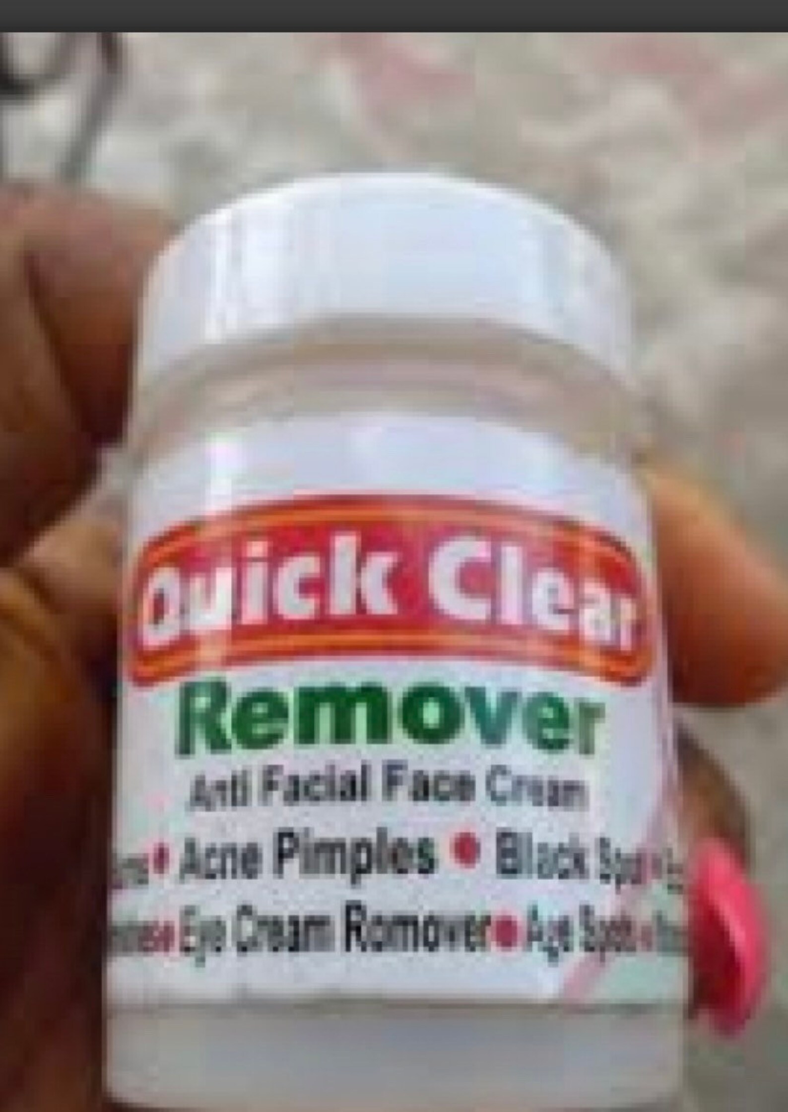 Quick Clear Face Cream for Remover AntiSpot sunburn acne / Etsy