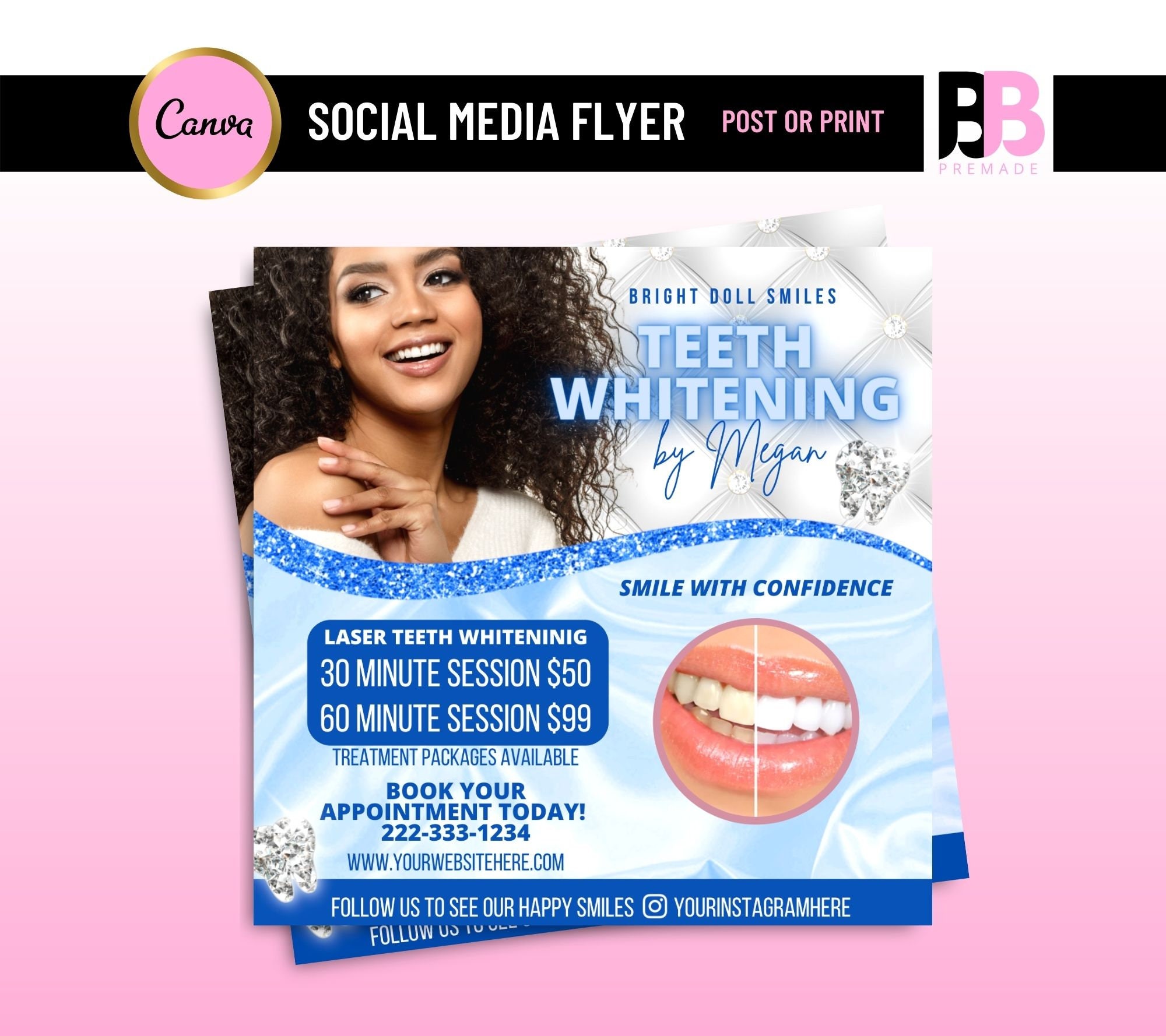Teeth Whitening Flyer Teeth Gems Teeth whitening dentistry Etsy España