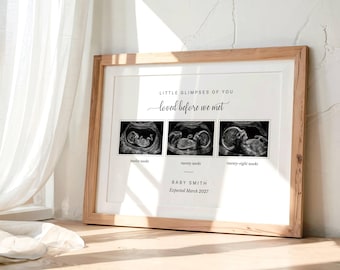 Baby Scan Photo Print, Mum To Be Gift, Pregnancy Announcement Keepsake, Custom Ultrasound Print, New Baby Wall Art, Expectant Mum Gift
