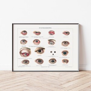 Póster vintage Medicina Enfermedades oculares | Alemán