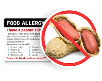 Peanut Allergy Translation Card • Professionally Translated Dining Card • Select from 50 Languages •  Durable Plastic Card • Equal Eats