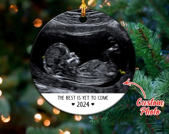 Baby Scan Best Yet To Come, Ultrasound Baby Personnalisé 1er ornement de Noël Boule à suspendre Décor d'arbre de Noël 2023, Mon premier Noël