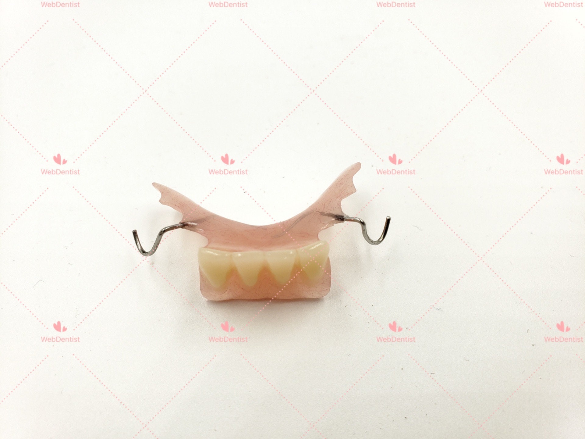Custom Made Flipper/Stayplate Partial Denture up to 3 teeth Etsy