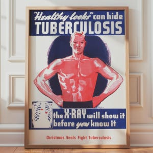 May include: A vintage-style poster in a light wood frame featuring a red-toned illustration of a person with hands on hips. Text reads: "Healthy looks" can hide TUBERCULOSIS, the X-RAY will show it before you know it, Christmas Seals Fight Tuberculosis.