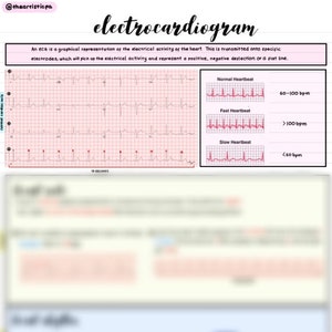 May include: A black and white electrocardiogram (ECG) chart with a grid pattern. The chart shows a normal heartbeat, a fast heartbeat, and a slow heartbeat. The chart also includes the text "An ECG is a graphical representation of the electrical activity of the heart. This is transmitted onto specific electrodes, which will pick up the electrical activity and represent a positive, negative deflection or a flat line."