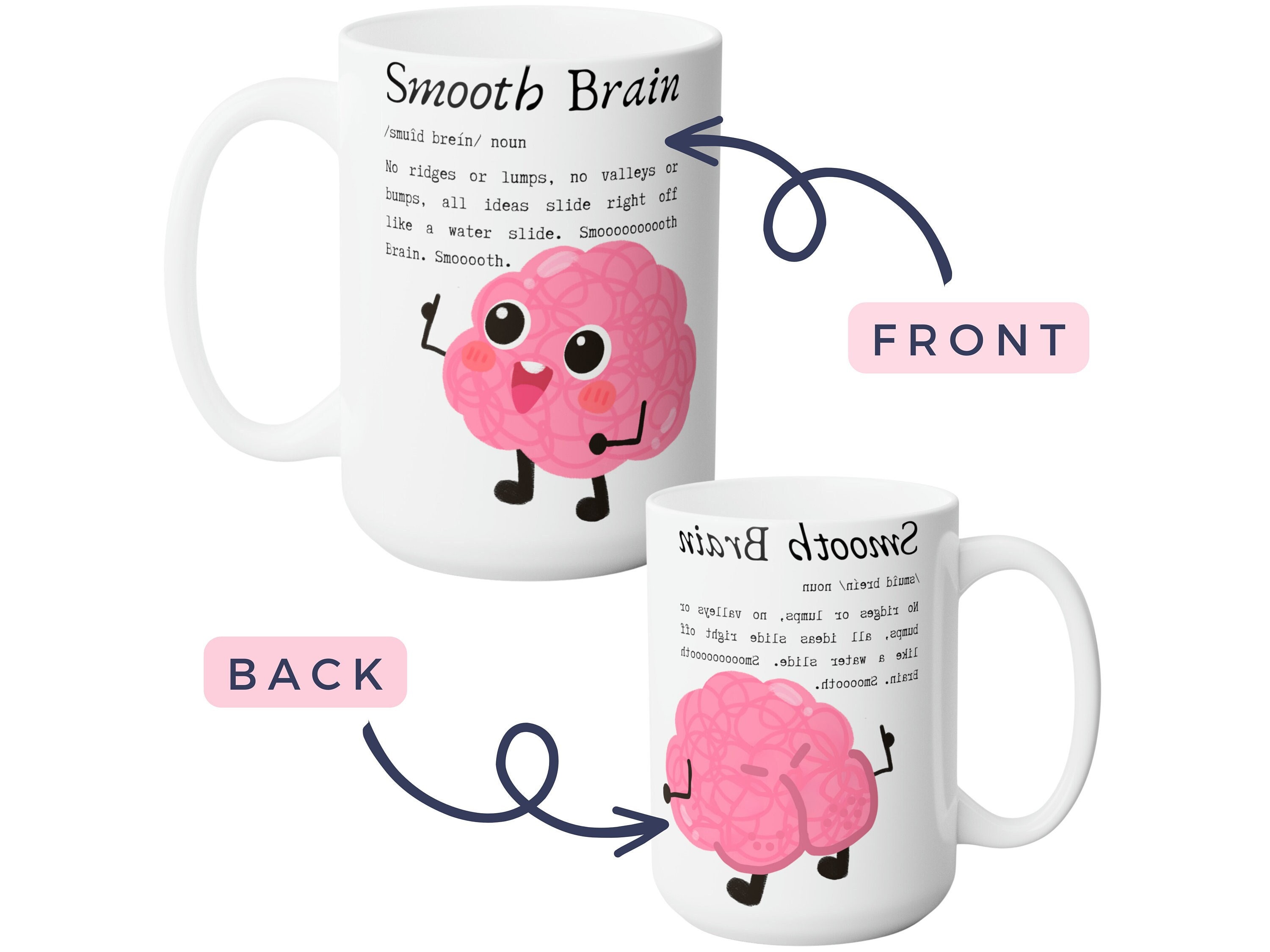 Coffee makes my brain go Weee!! coffee mug - The Artsy Spot