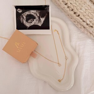 May include: A gold necklace with flower pendants and a matching bracelet are displayed on a white, wavy tray. A small, peach-colored box with the word "MAMA" in gold lettering sits next to an ultrasound image.