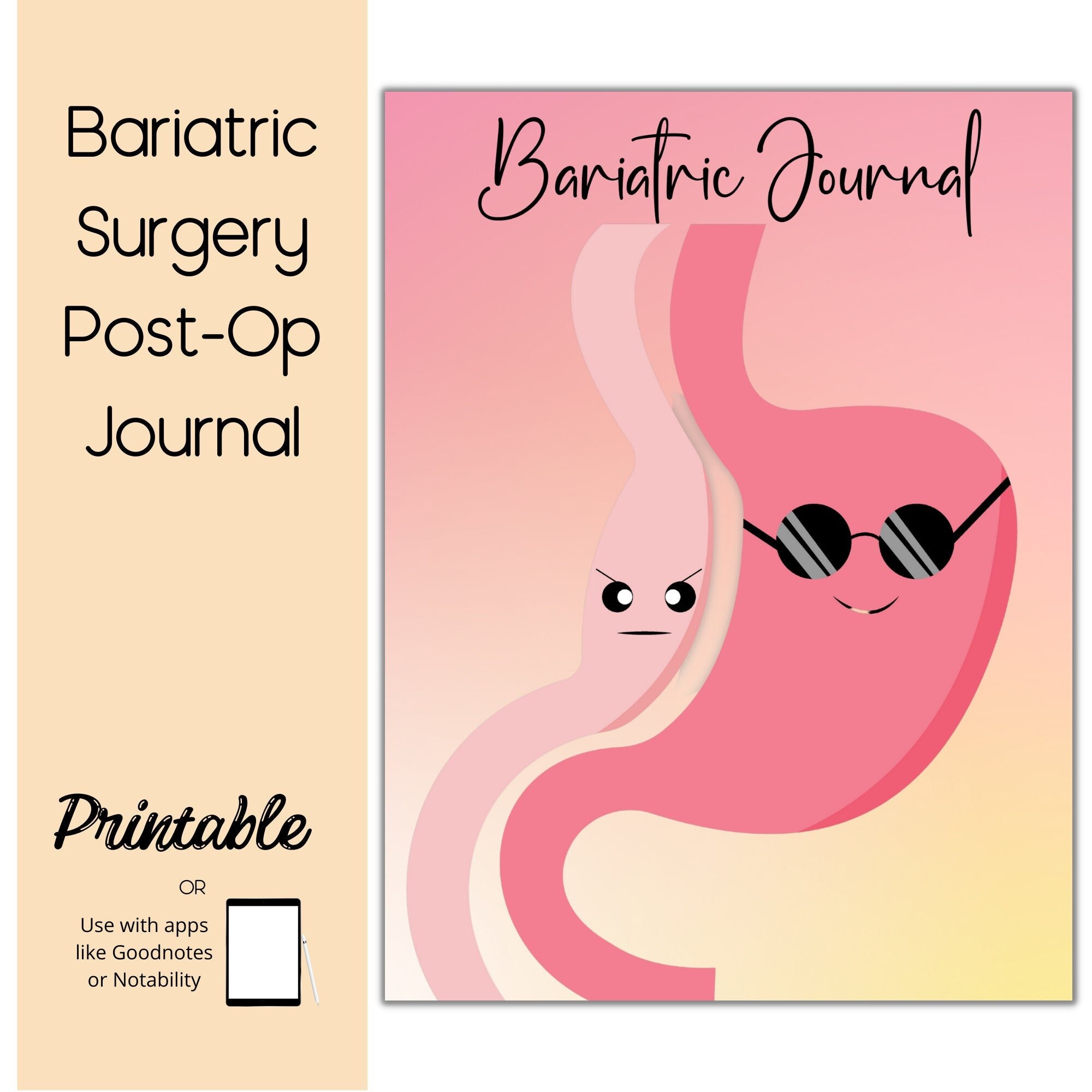 Bariatric Surgery Planner Gastric Bypass Journal - Etsy
