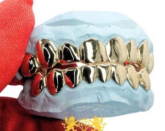 Custom Solid Gold Grillz, Full Top and Bottom Eight Tooth Mirror Polish Teeth Caps Set in Yellow Gold