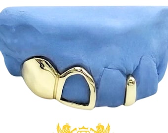 Custom Grillz: Open Face, Fangs, Gap Filler - Sterling Silver, 10K  Gold