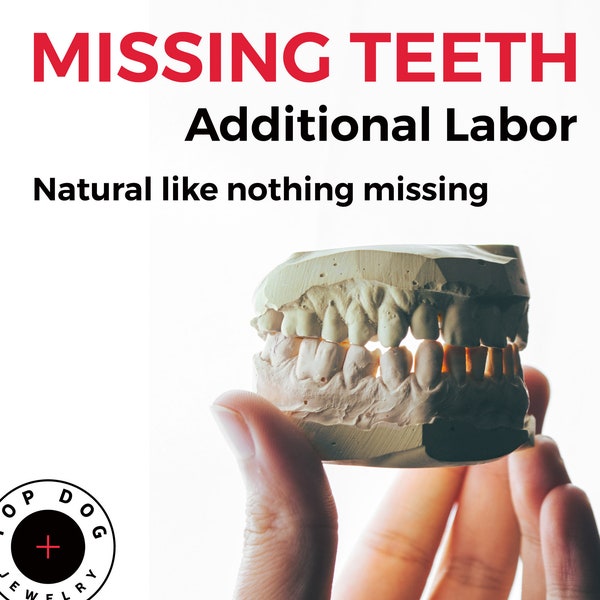 Extra labor added for those who have missing teeth and want their shiny smiles back, grillz made to look natural like nothing missing