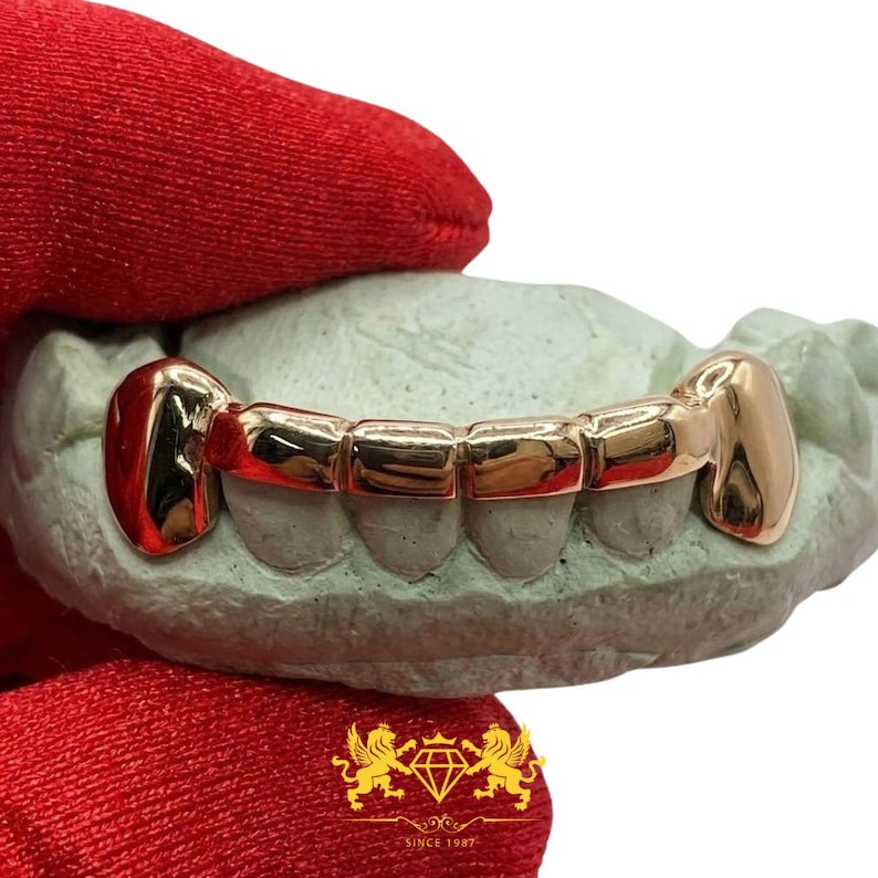 Custom 6-tooth rose gold grillz set with solid fangs and connecting horizontal bar held in red gloved hand