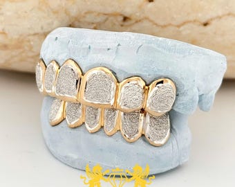 Grillz personalizado de dos tonos: polvo de diamante, plata 925 y oro