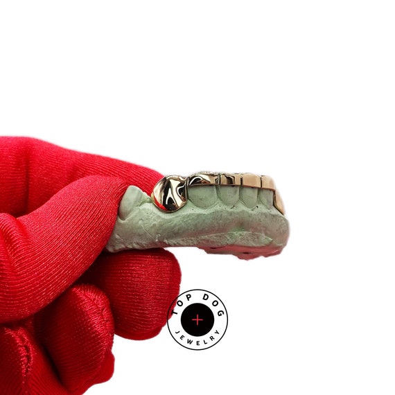 Custom Gold Grillz, Solid End, Half-Cut Teeth, FREE Mold Kit, Custom Solid Tooth.