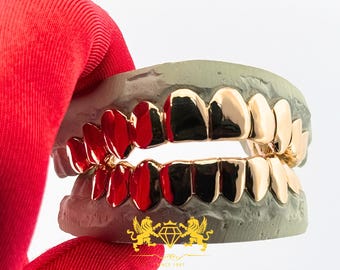 Custom Yellow Gold Grillz: Plain Design, 10K/14K/925 Silver