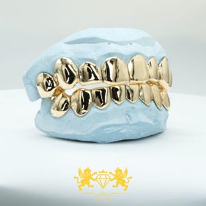 Custom Grillz: Yellow Gold Finish, Silver 925, 10K/14K Gold, Free Mold Kit
